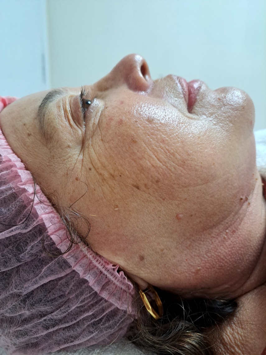 Trabalho de Esteticista por Danielly Cecilia Penalber em Santana, São Paulo — foto 3 de 9