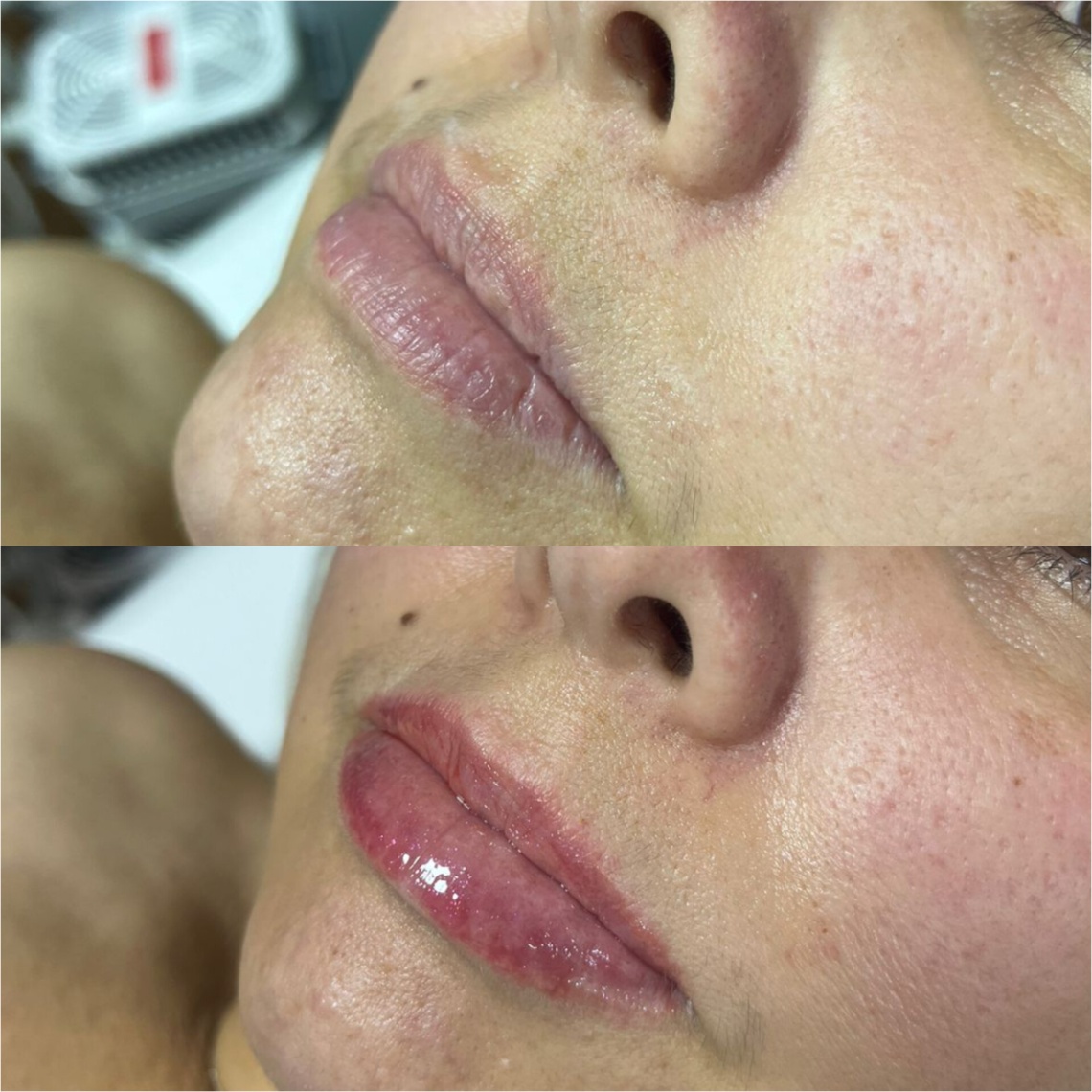 Trabalho de Esteticista por Karoline Silva em Parque Paulistano, São Paulo — foto 1 de 8