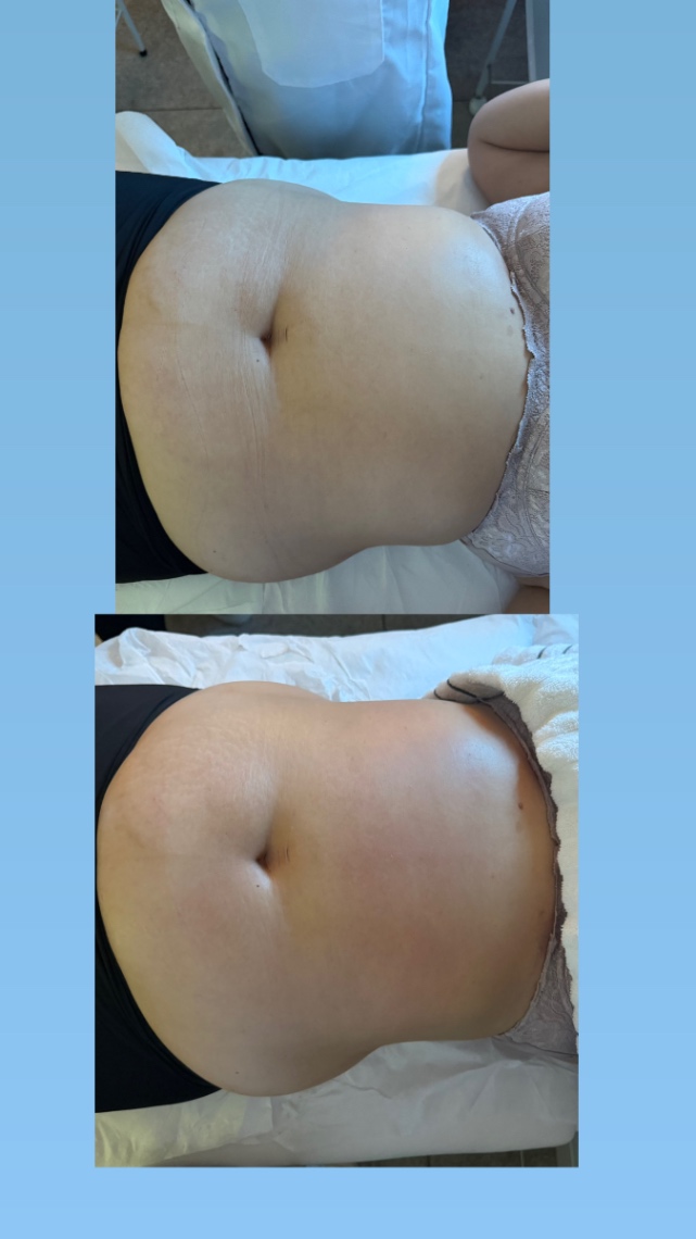 Trabalho de Esteticista por Bruna Peres em Jardim Norma, São Paulo — foto 4 de 5
