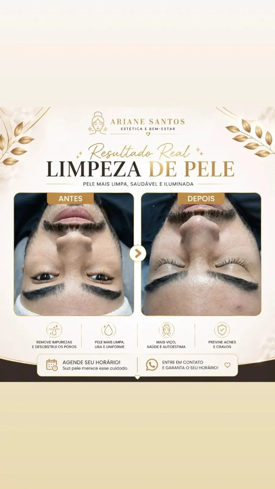Trabalho de Esteticista por Aariane dos santos em Jardim Popular, Carapicuíba — foto 1 de 3