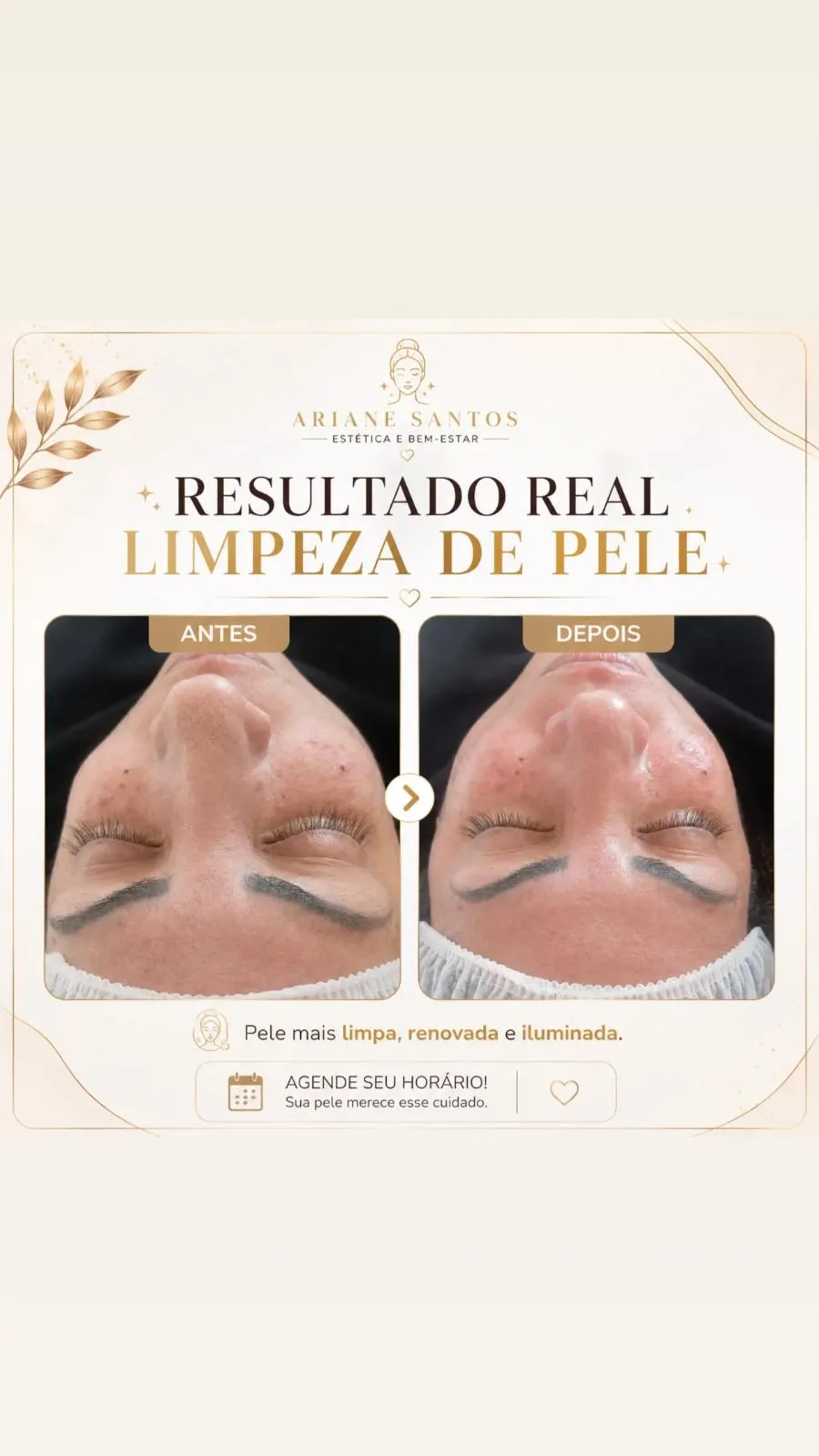 Trabalho de Esteticista por Aariane dos santos em Jardim Popular, Carapicuíba — foto 2 de 3