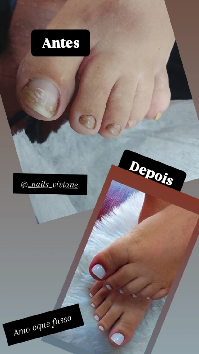 Trabalho de Manicure/Pedicure por Viviane Oliveira em Vila Itaberaba, São Paulo — foto 7 de 7