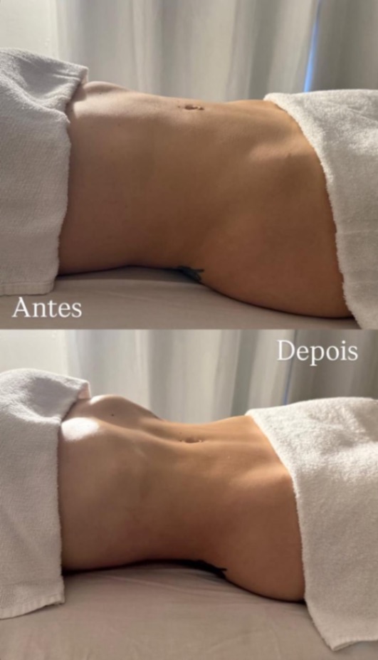 Trabalho de Massoterapeuta por Cassiane sousa em Jardim das Pedras(Zona Sul), São Paulo — foto 2 de 4