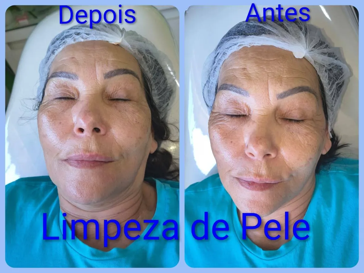 Trabalho de Esteticista por Lilian Marques em Jardim Luella, Suzano — foto 5 de 5