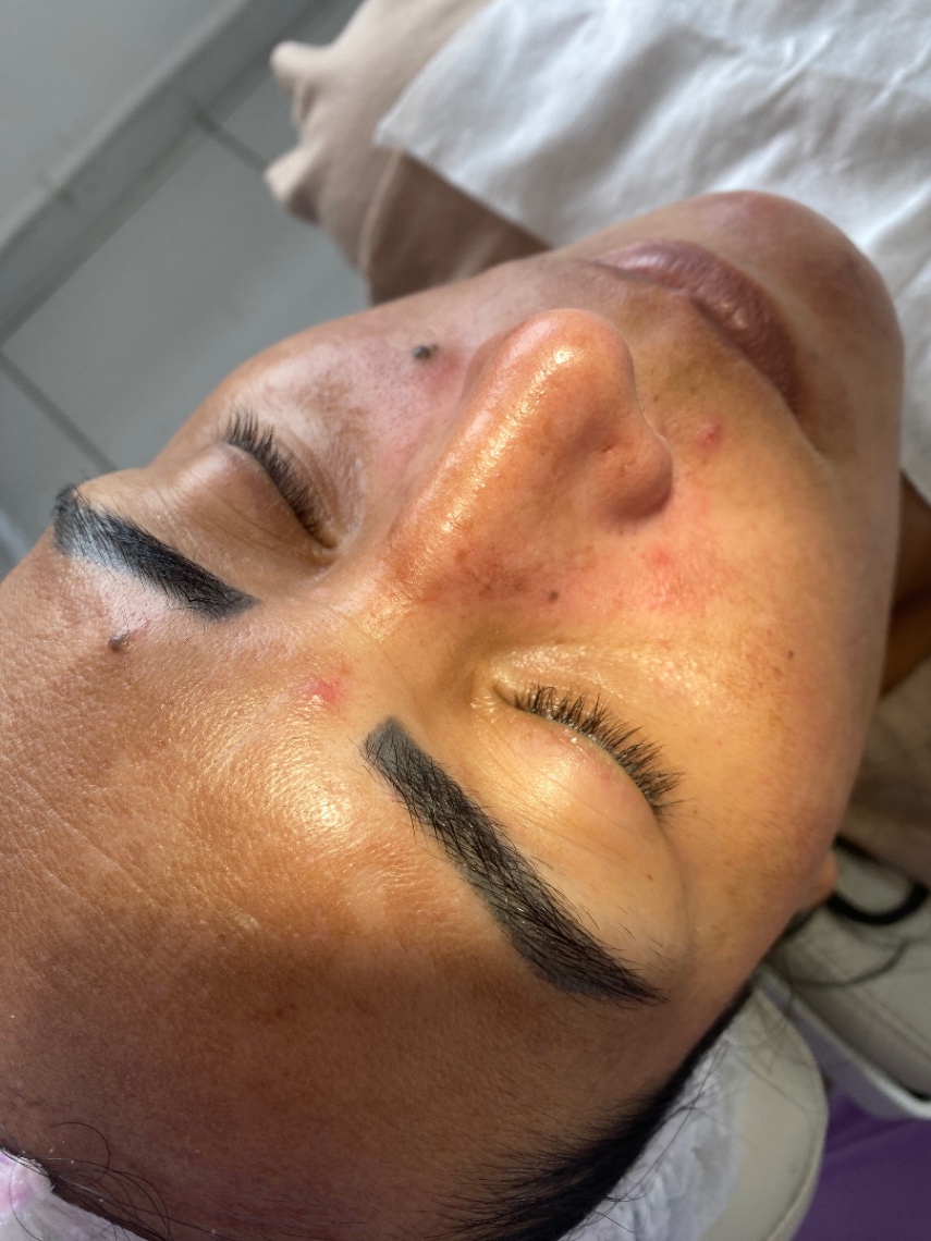 Trabalho de Esteticista por Leticia Lopes em Balneário Mar Paulista, São Paulo — foto 1 de 14