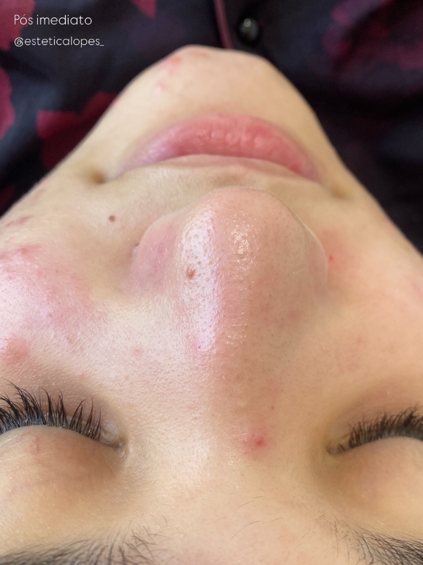 Trabalho de Esteticista por Leticia Lopes em Balneário Mar Paulista, São Paulo — foto 2 de 14