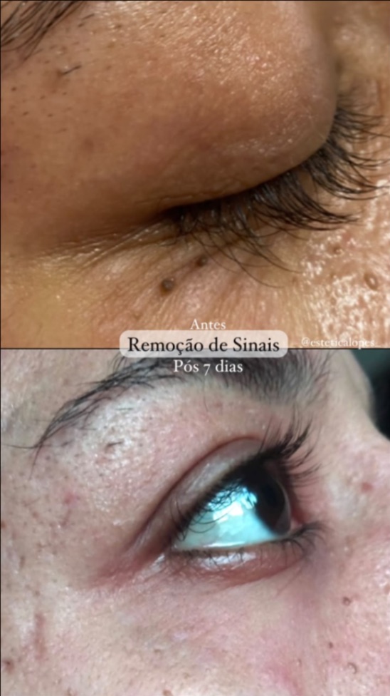 Trabalho de Esteticista por Leticia Lopes em Balneário Mar Paulista, São Paulo — foto 4 de 14