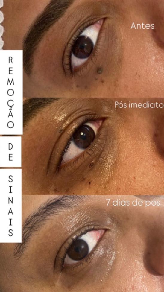 Trabalho de Esteticista por Leticia Lopes em Balneário Mar Paulista, São Paulo — foto 5 de 14