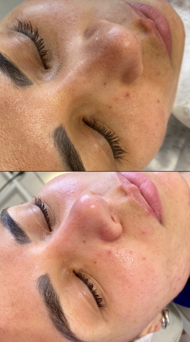 Trabalho de Esteticista por Leticia Lopes em Balneário Mar Paulista, São Paulo — foto 6 de 14