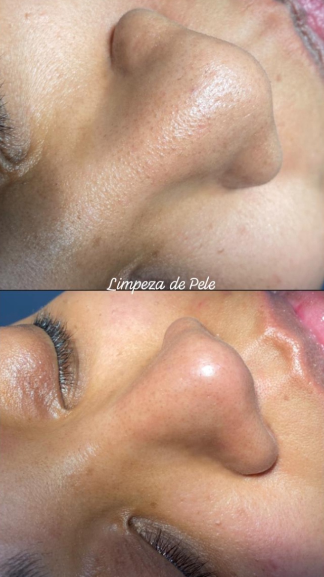 Trabalho de Esteticista por Leticia Lopes em Balneário Mar Paulista, São Paulo — foto 7 de 14
