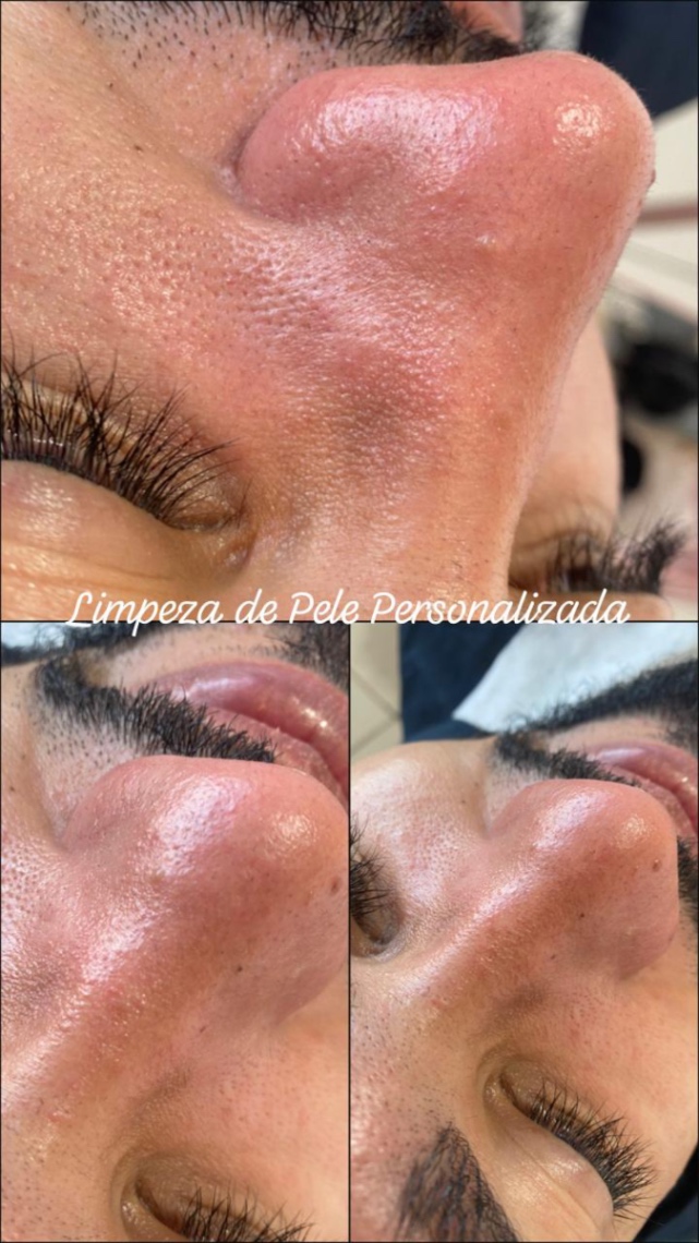 Trabalho de Esteticista por Leticia Lopes em Balneário Mar Paulista, São Paulo — foto 8 de 14