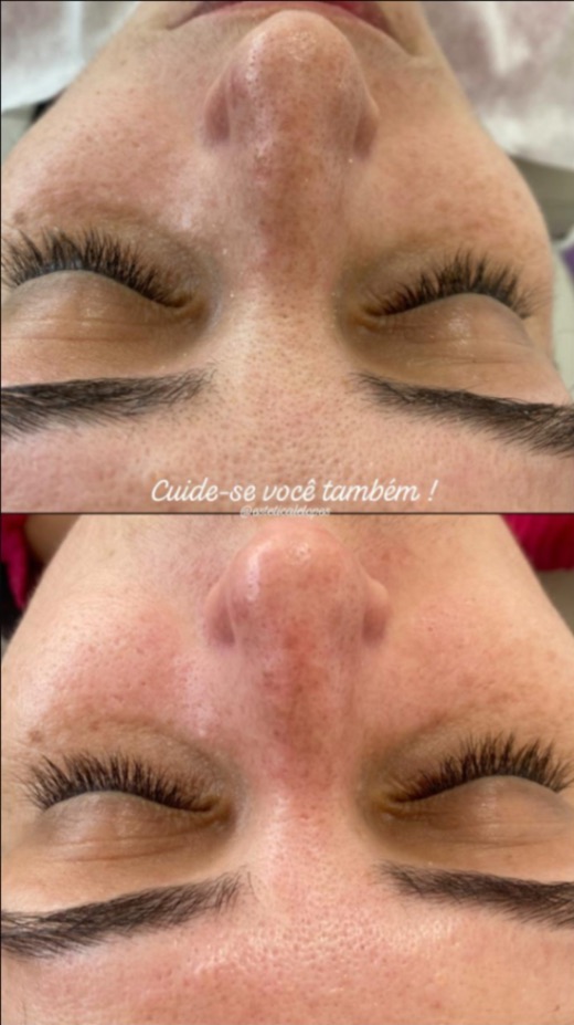 Trabalho de Esteticista por Leticia Lopes em Balneário Mar Paulista, São Paulo — foto 13 de 14