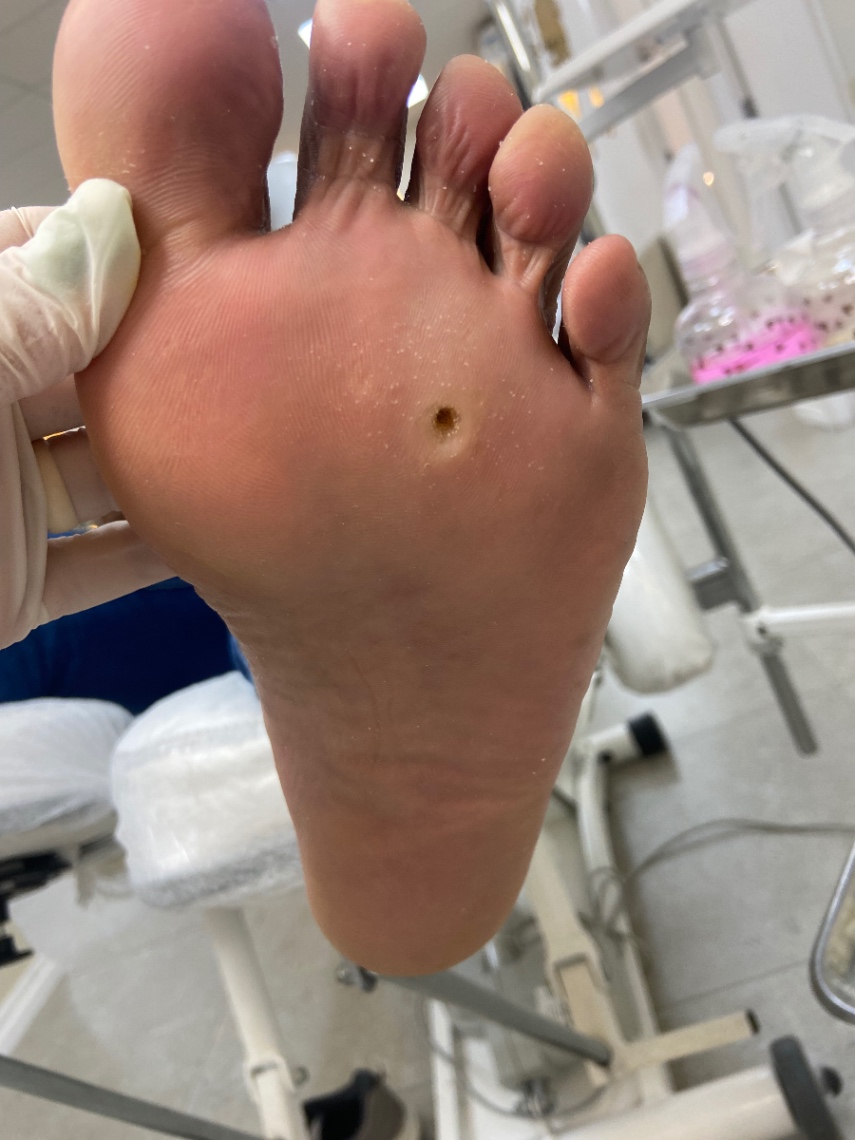 Trabalho de Podólogo(a) por Cinthia Sampaio em Cidade Ariston Estela Azevedo, Carapicuíba — foto 3 de 11