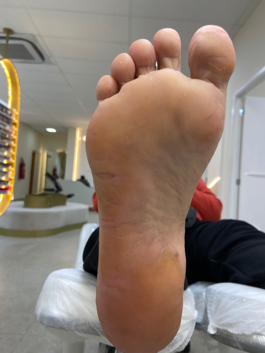 Trabalho de Podólogo(a) por Cinthia Sampaio em Cidade Ariston Estela Azevedo, Carapicuíba — foto 4 de 11