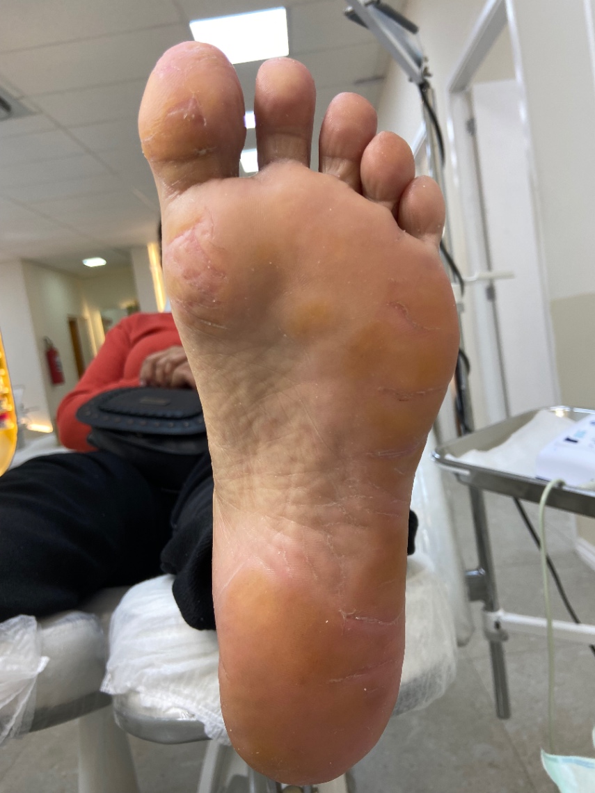 Trabalho de Podólogo(a) por Cinthia Sampaio em Cidade Ariston Estela Azevedo, Carapicuíba — foto 5 de 11
