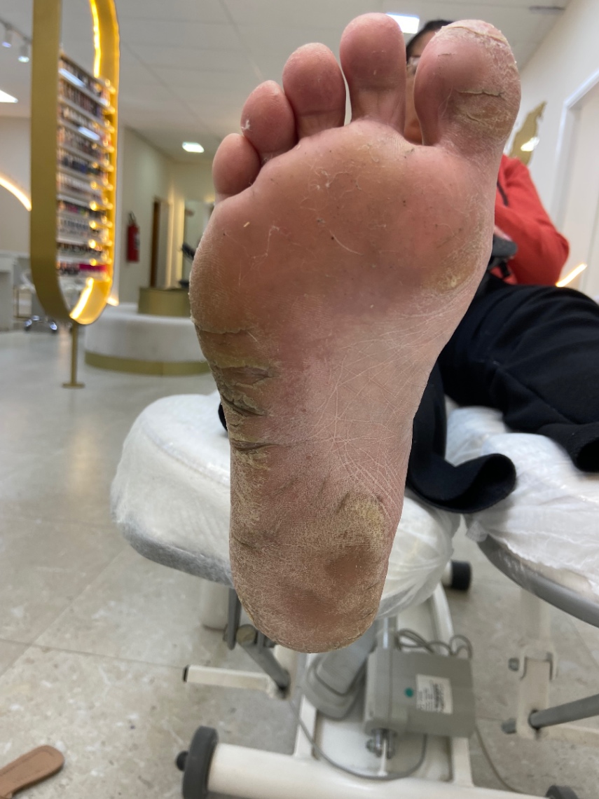Trabalho de Podólogo(a) por Cinthia Sampaio em Cidade Ariston Estela Azevedo, Carapicuíba — foto 6 de 11