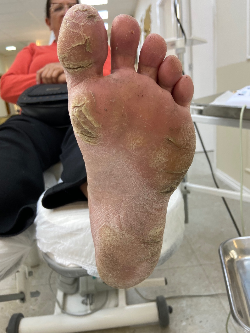Trabalho de Podólogo(a) por Cinthia Sampaio em Cidade Ariston Estela Azevedo, Carapicuíba — foto 7 de 11
