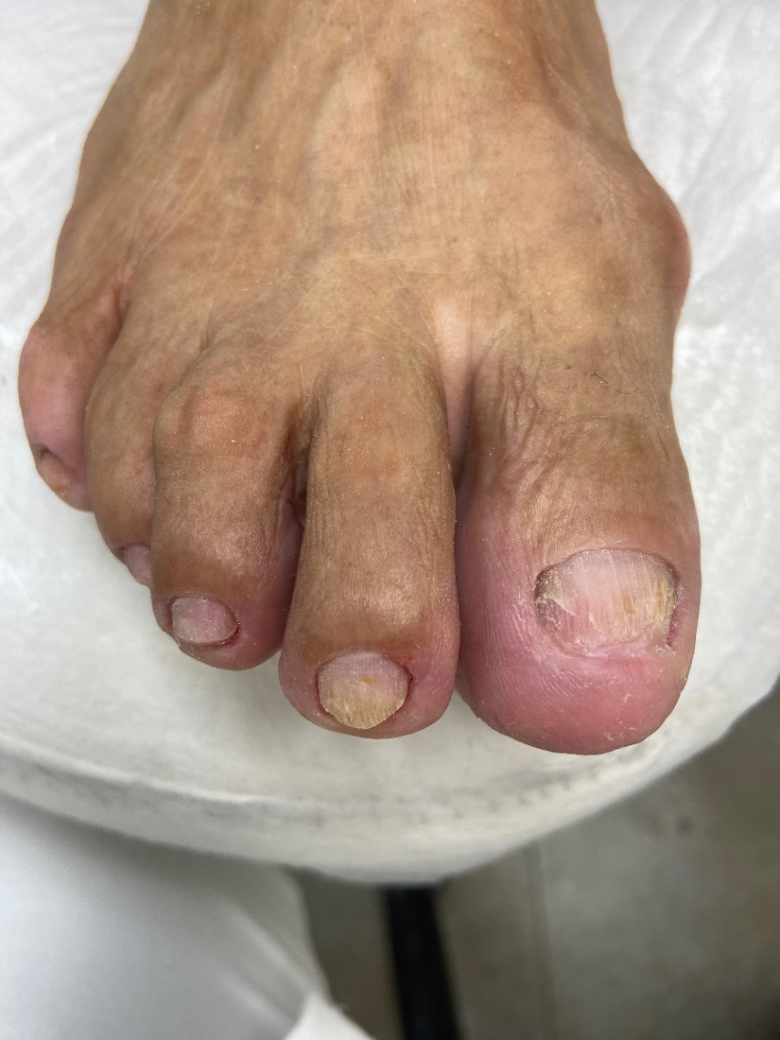Trabalho de Podólogo(a) por Cinthia Sampaio em Cidade Ariston Estela Azevedo, Carapicuíba — foto 8 de 11