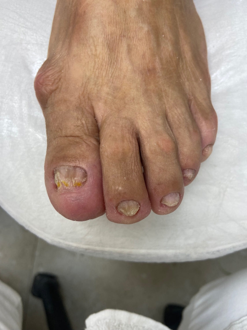 Trabalho de Podólogo(a) por Cinthia Sampaio em Cidade Ariston Estela Azevedo, Carapicuíba — foto 9 de 11