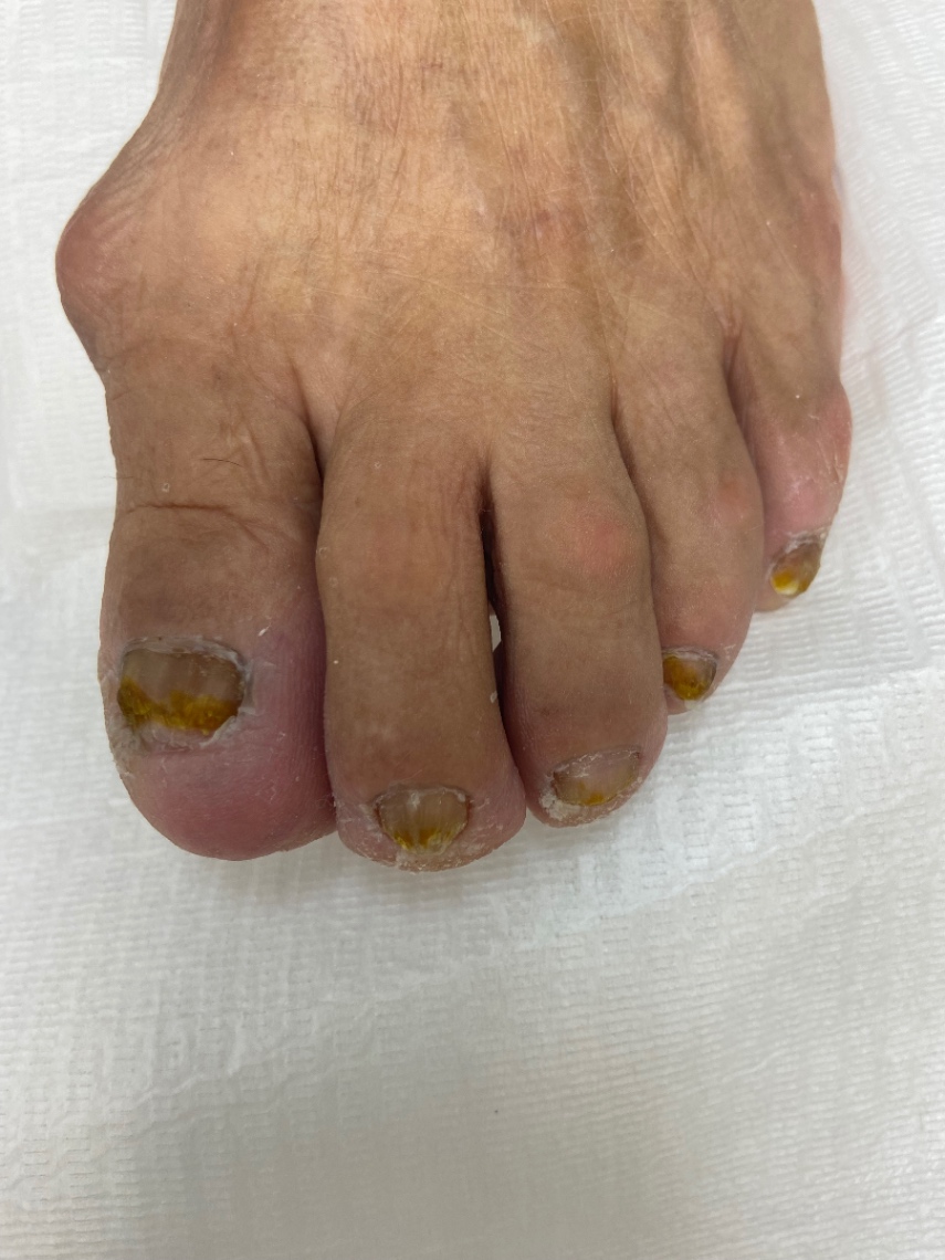 Trabalho de Podólogo(a) por Cinthia Sampaio em Cidade Ariston Estela Azevedo, Carapicuíba — foto 10 de 11