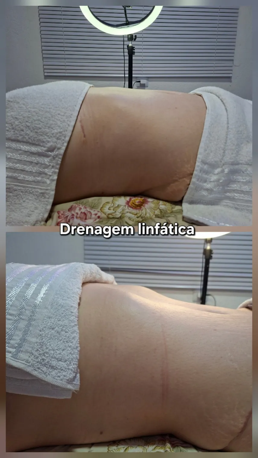 Trabalho de Massoterapeuta por Jussara Marques em Vila Nova Curuçá, São Paulo — foto 18 de 22