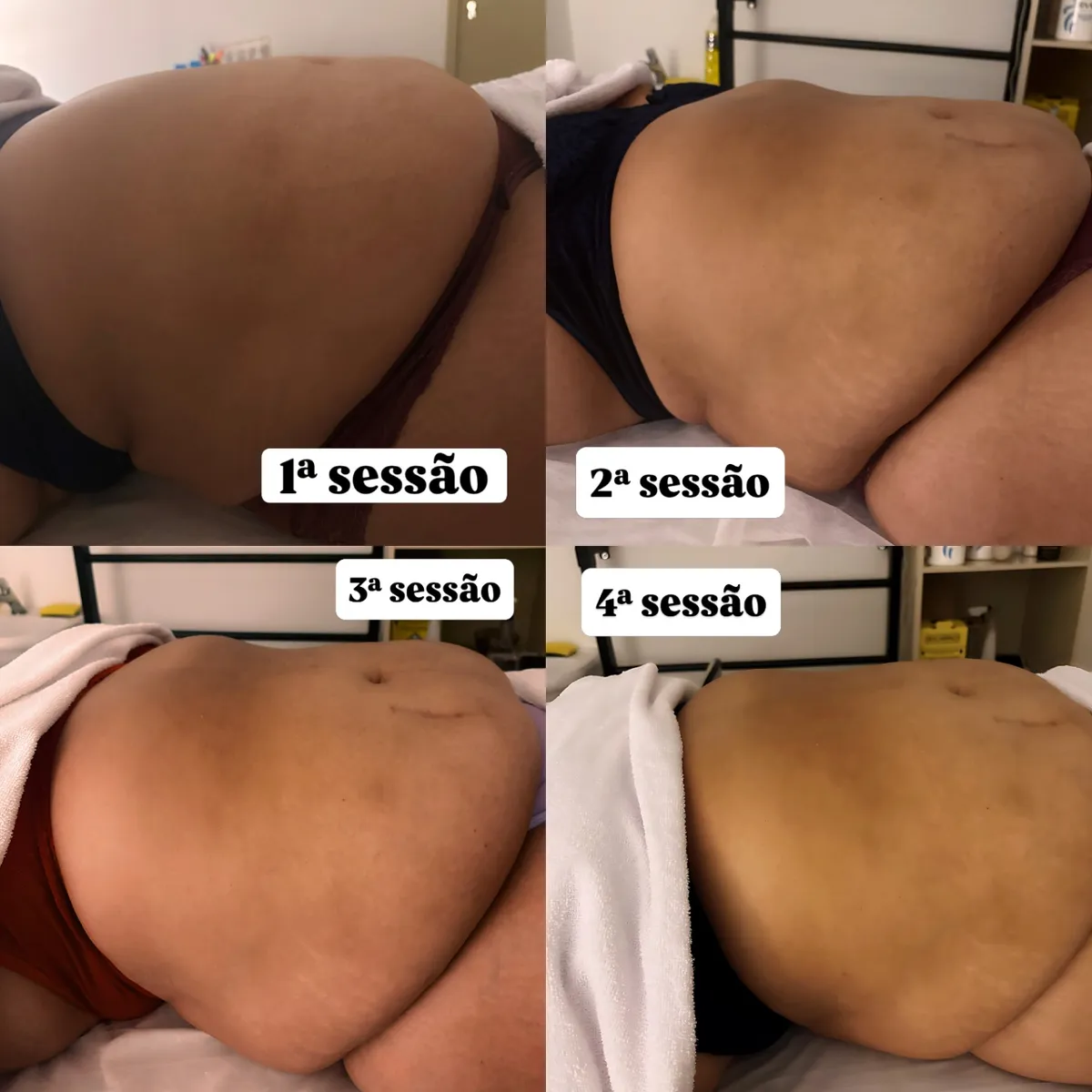 Trabalho de Massoterapeuta por Thais de Souza Silva em Macedo, Guarulhos — foto 7 de 17