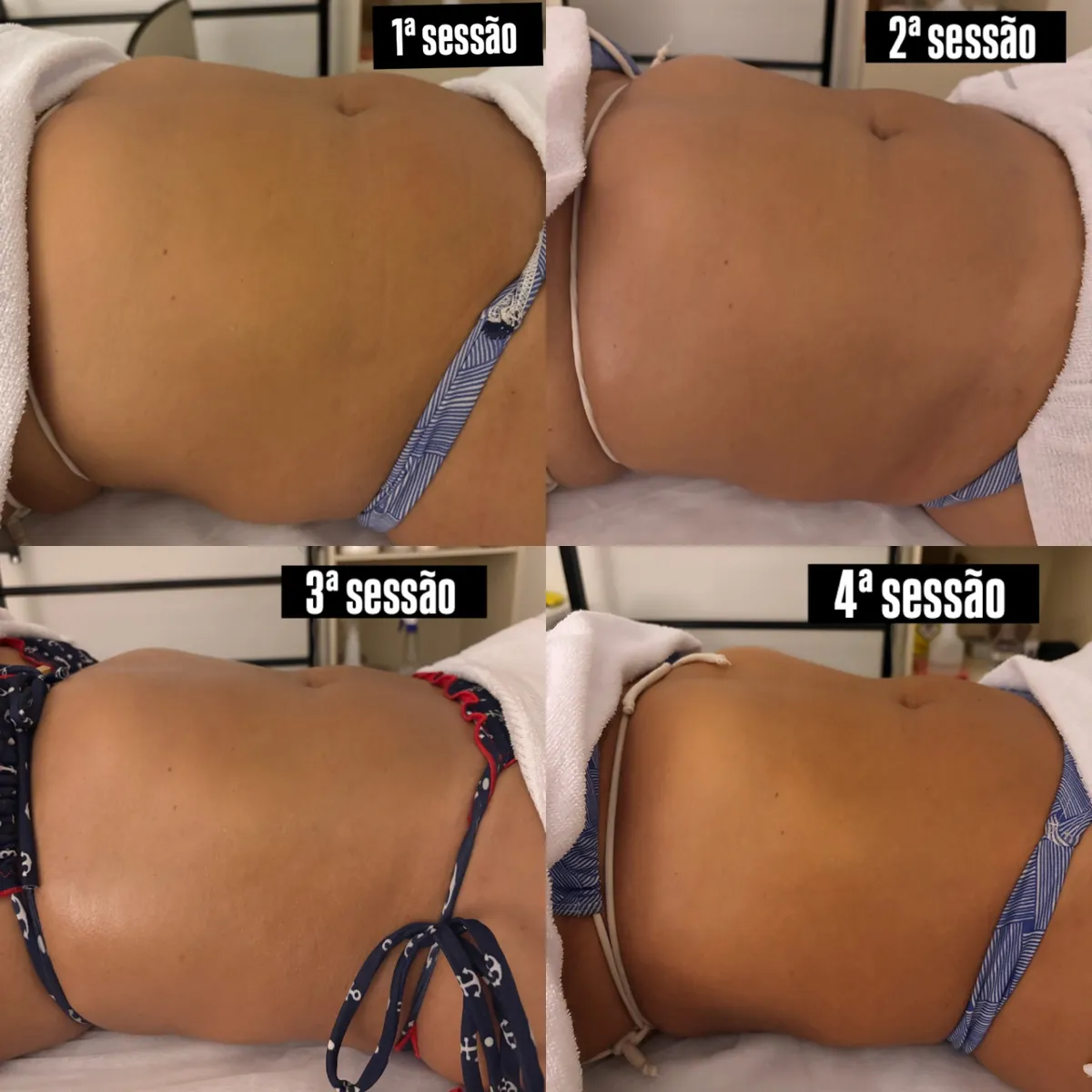 Trabalho de Massoterapeuta por Thais de Souza Silva em Macedo, Guarulhos — foto 8 de 17