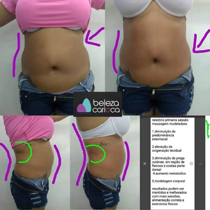 Trabalho de Esteticista por Julyane Castro e magalhaes em Jardim Iae, São Paulo — foto 1 de 3