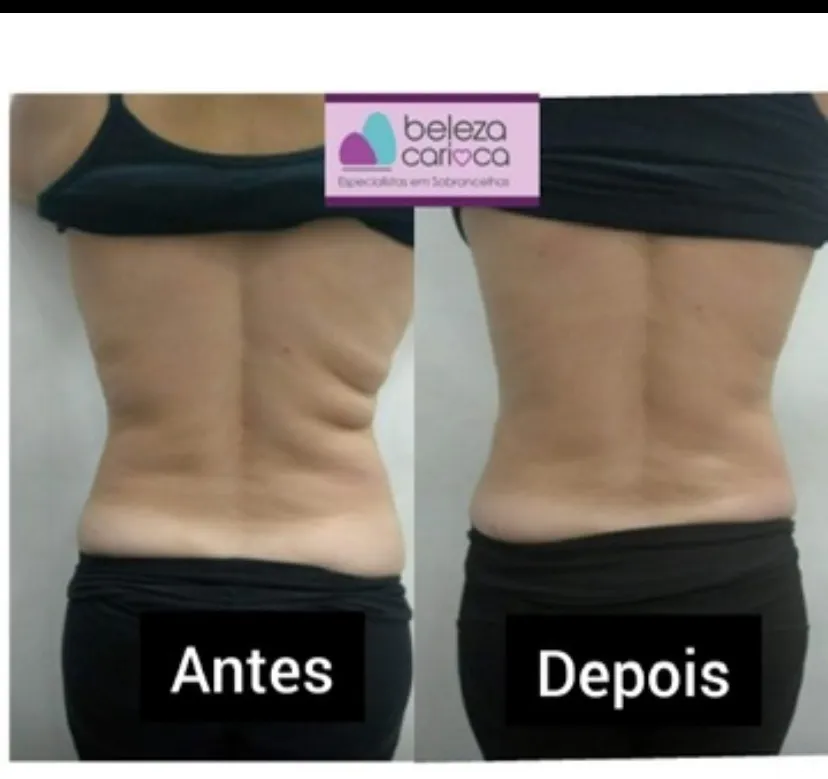 Trabalho de Esteticista por Julyane Castro e magalhaes em Jardim Iae, São Paulo — foto 3 de 3