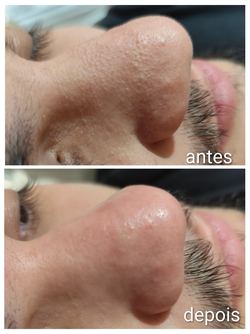 Trabalho de Esteticista por Isabelle Sauer Corradini em Santa Maria, São Caetano do Sul — foto 1 de 3