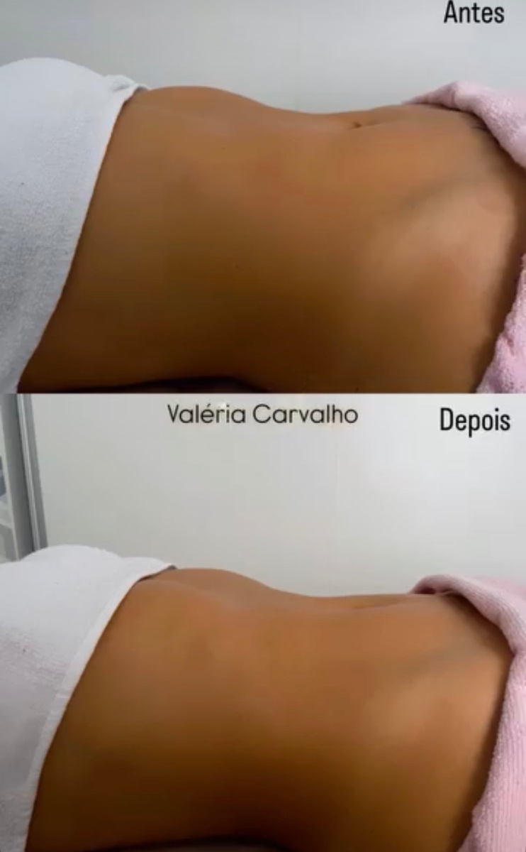 Trabalho de Esteticista por Valéria Martins Silva de Carvalho em Conjunto Habitacional Padre José de Anchieta, São Paulo — foto 3 de 10