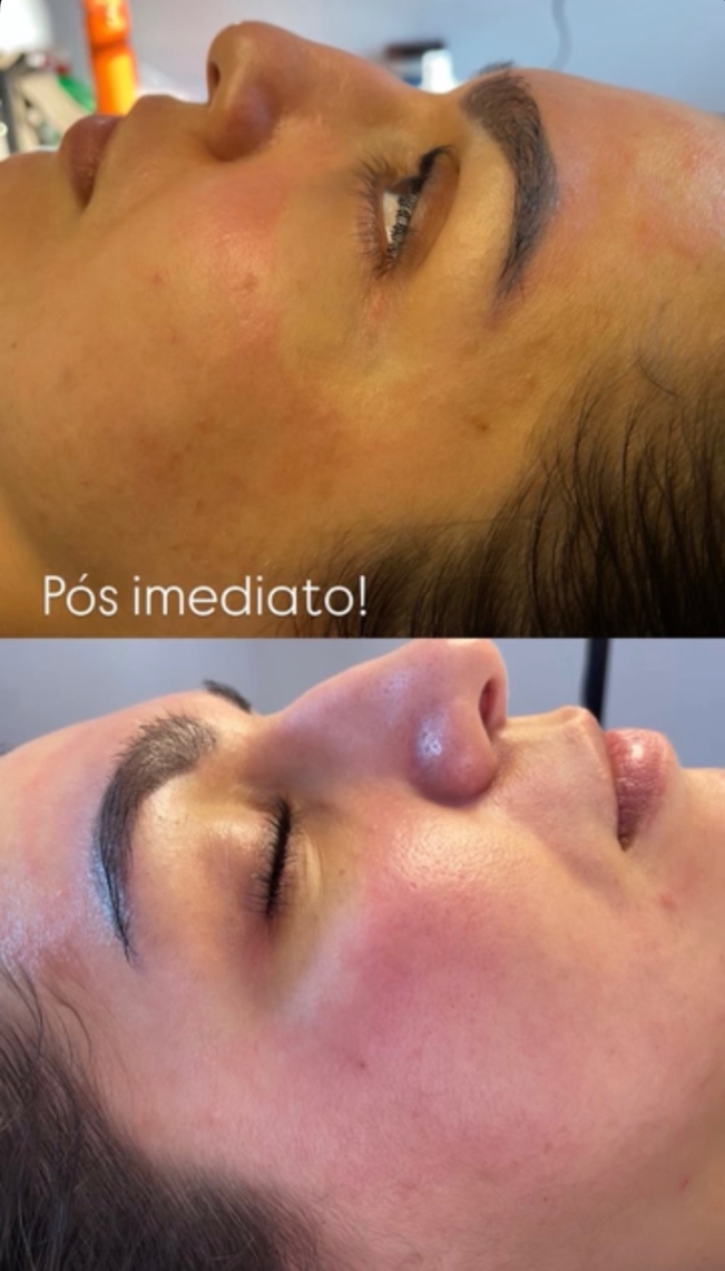 Trabalho de Esteticista por Valéria Martins Silva de Carvalho em Conjunto Habitacional Padre José de Anchieta, São Paulo — foto 7 de 10