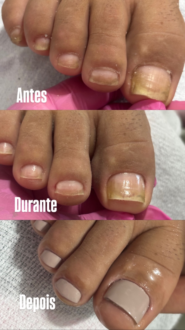 Trabalho de Manicure/Pedicure por Bruna Ferreira em Parque Esperança, São Paulo — foto 7 de 10