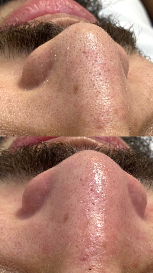 Trabalho de Esteticista por Maria Lopes em Jardim Record, Taboão da Serra — foto 8 de 8