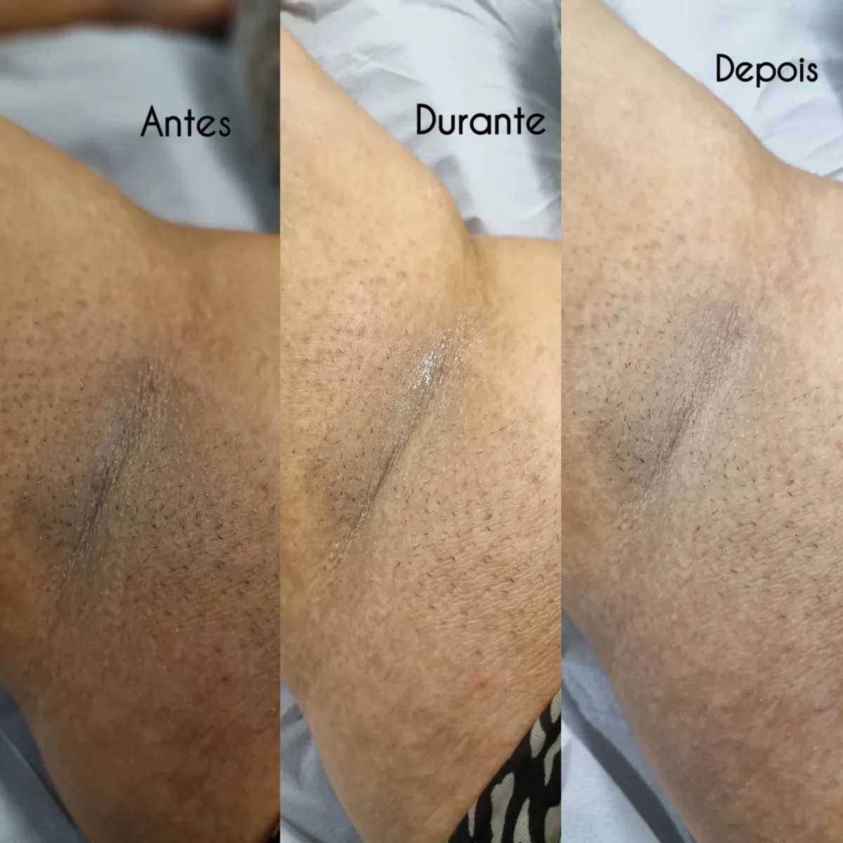 Trabalho de Esteticista por Ana Carolina Martins de Freitas em Vila Margareth, São Paulo — foto 1 de 7