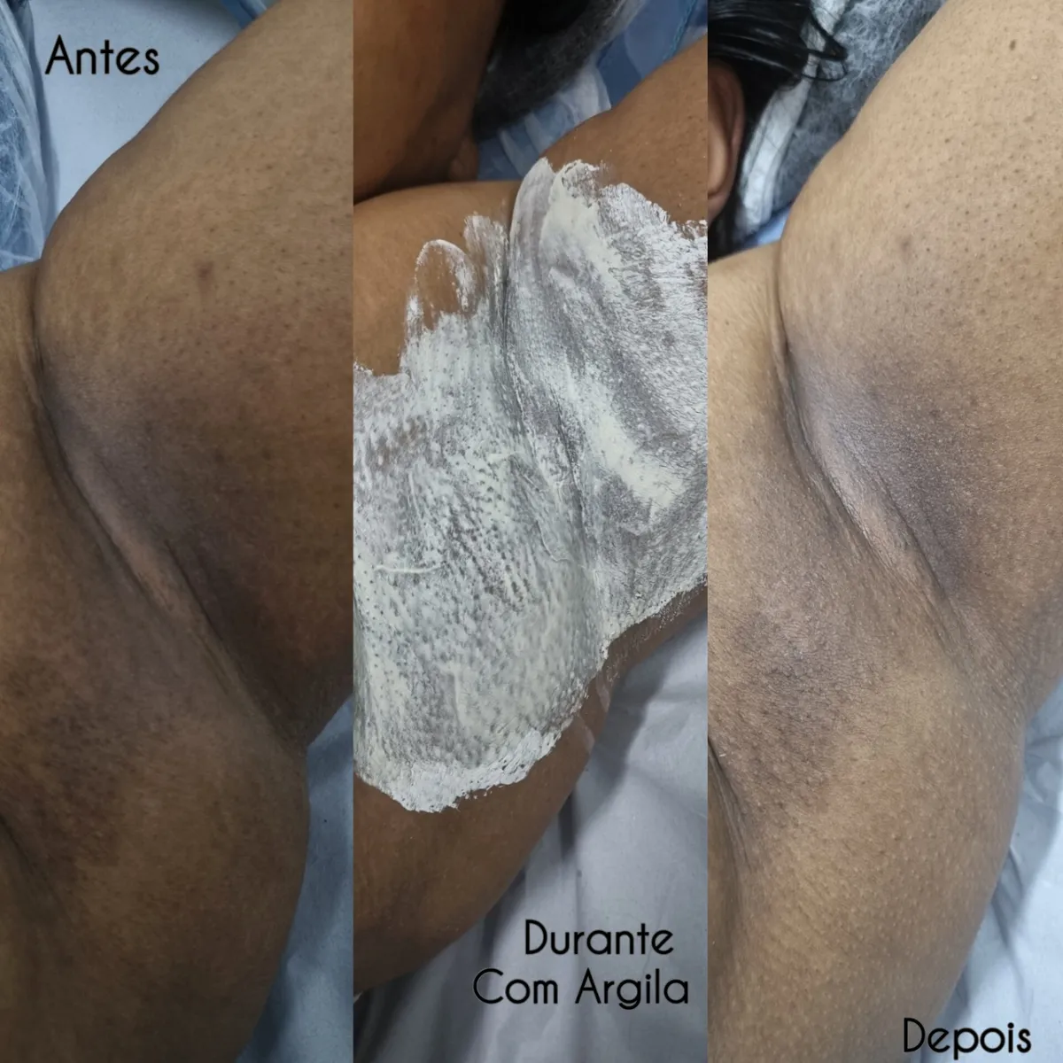 Trabalho de Esteticista por Ana Carolina Martins de Freitas em Vila Margareth, São Paulo — foto 2 de 7