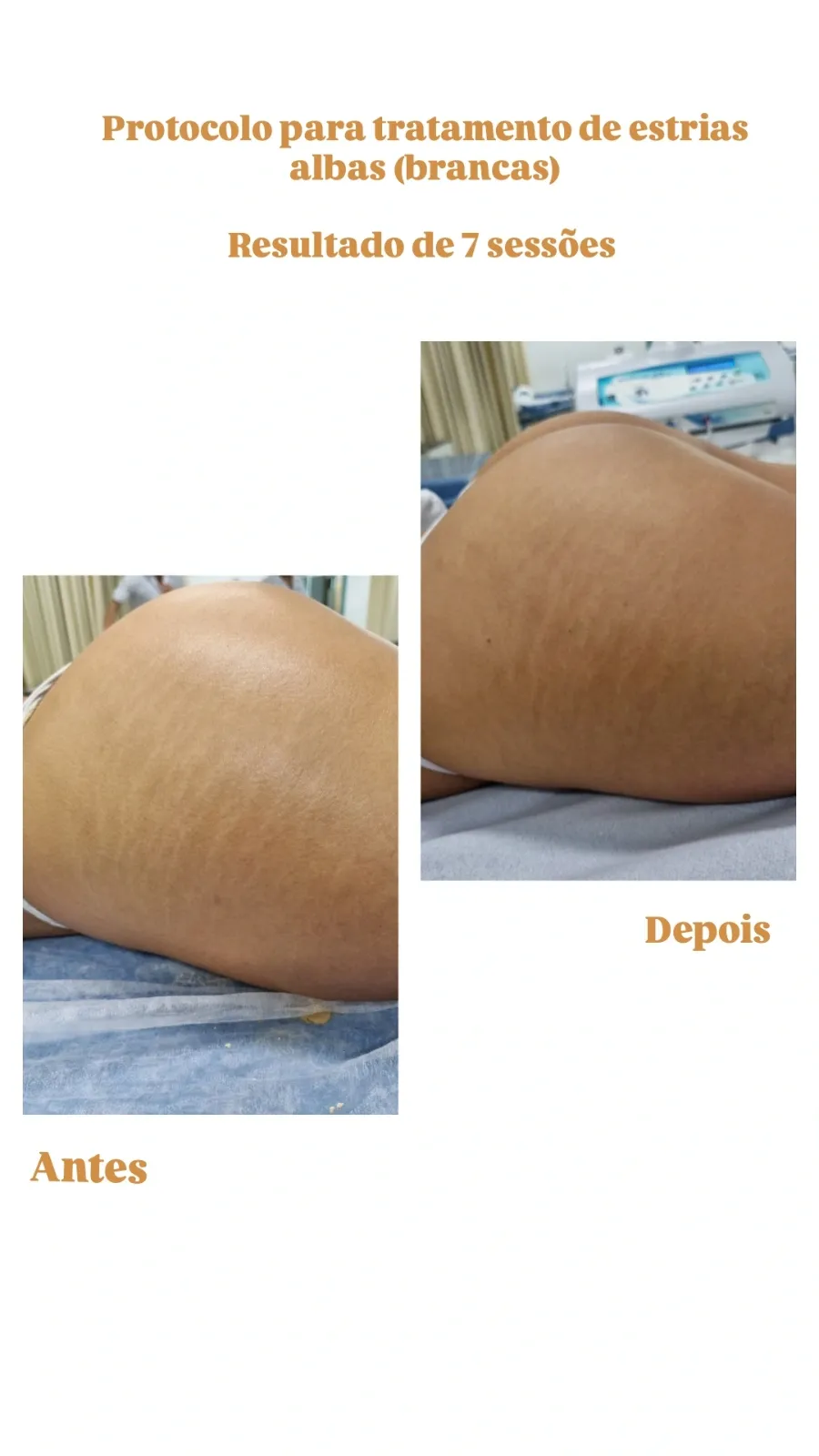 Trabalho de Esteticista por Ana Carolina Martins de Freitas em Vila Margareth, São Paulo — foto 7 de 7