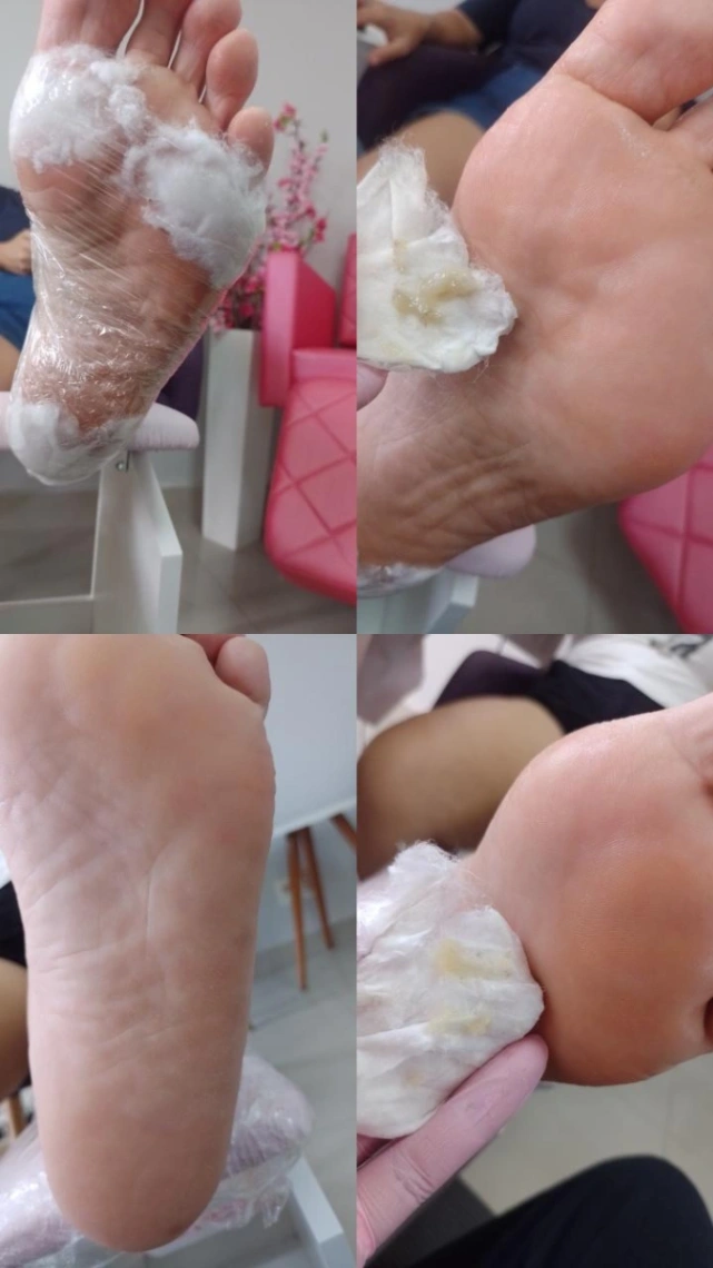 Trabalho de Manicure/Pedicure por Lais Dos Santos em Jardim Capão Redondo, São Paulo — foto 7 de 15