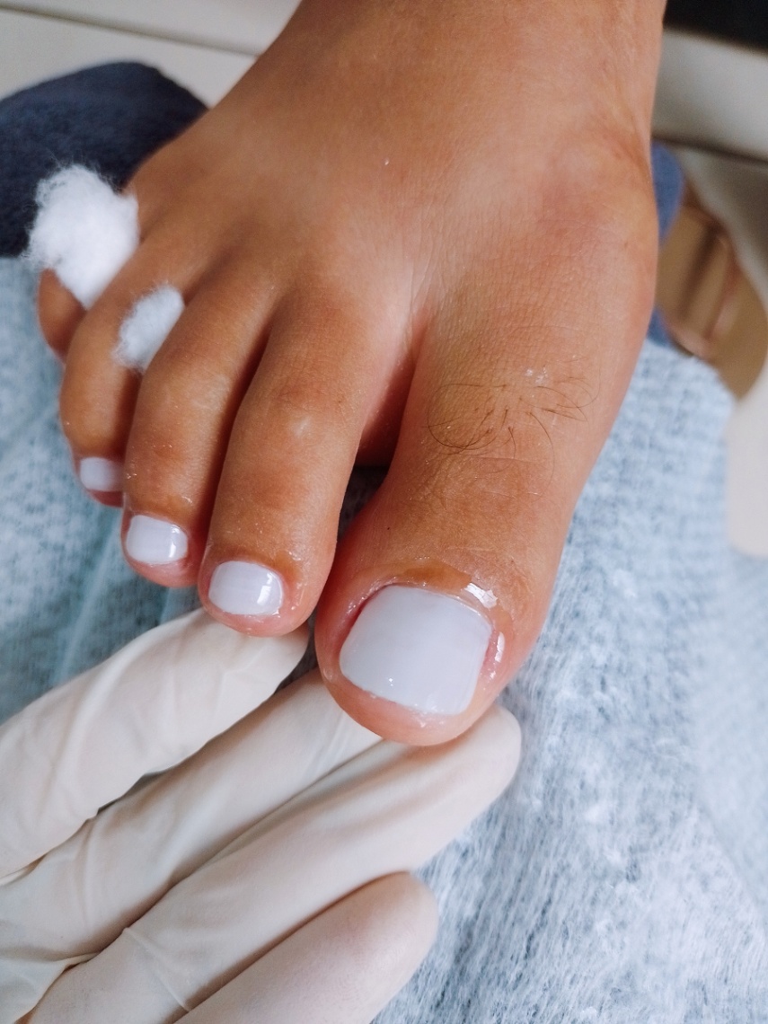 Trabalho de Manicure/Pedicure por Lais Dos Santos em Jardim Capão Redondo, São Paulo — foto 8 de 15