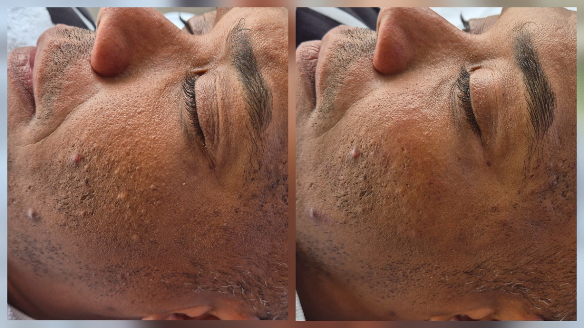 Trabalho de Esteticista por Nara Laranjeira em Lauzane Paulista, São Paulo — foto 2 de 3