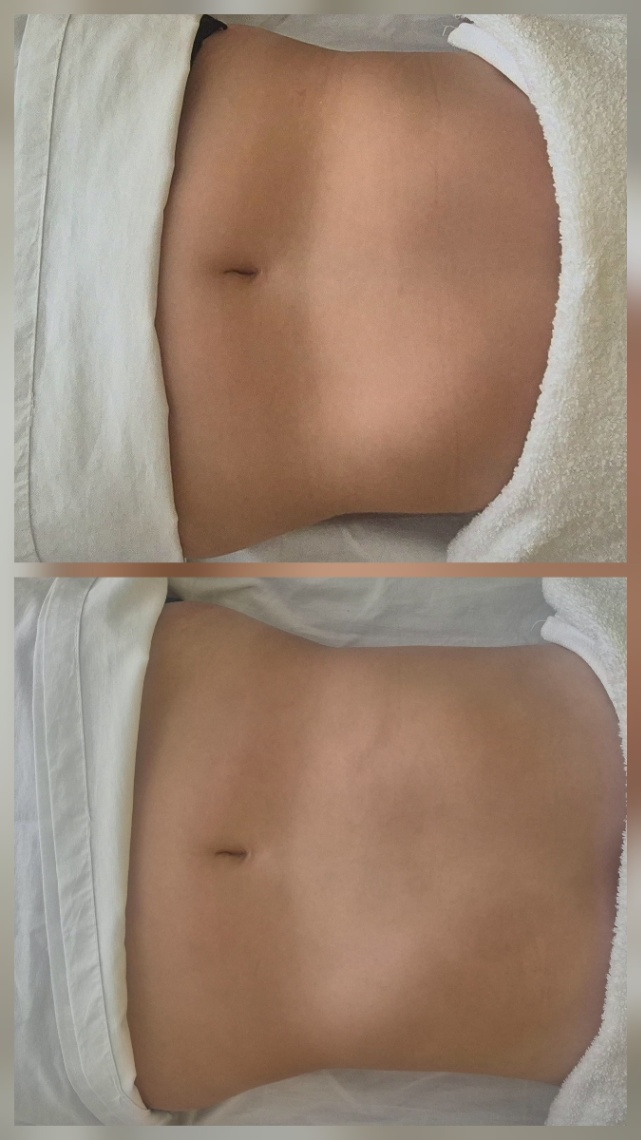Trabalho de Esteticista por Nara Laranjeira em Lauzane Paulista, São Paulo — foto 3 de 3