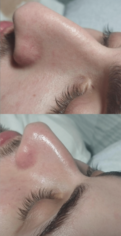 Trabalho de Esteticista por Evellyn Rayssa em Jardim Maria Estela, São Paulo — foto 1 de 2