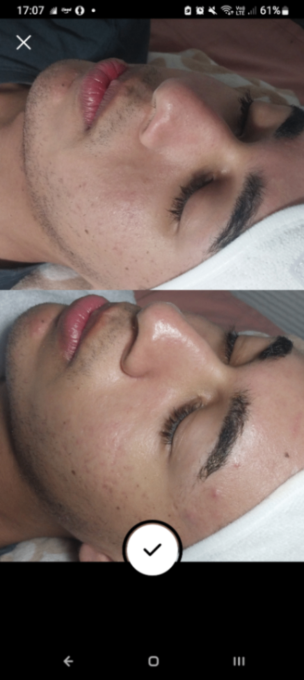 Trabalho de Esteticista por Evellyn Rayssa em Jardim Maria Estela, São Paulo — foto 2 de 2