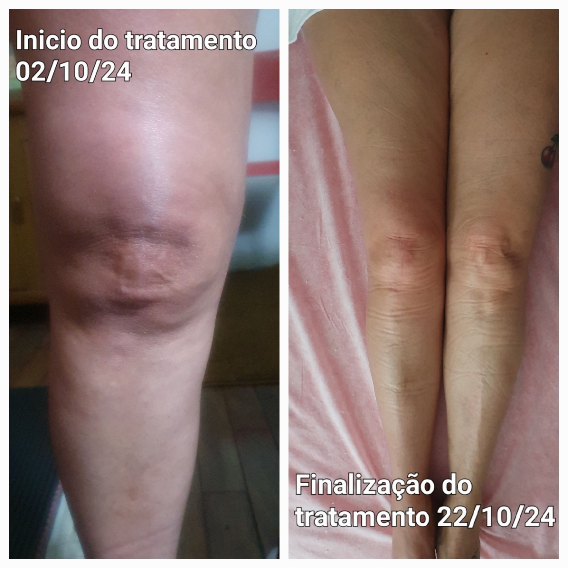 Trabalho de Massoterapeuta por Rita de Cassia Garcia de Paula em Demarchi, São Bernardo do Campo — foto 4 de 6