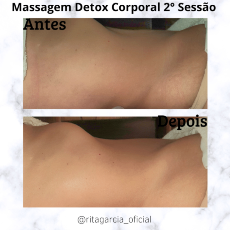 Trabalho de Massoterapeuta por Rita de Cassia Garcia de Paula em Demarchi, São Bernardo do Campo — foto 6 de 6