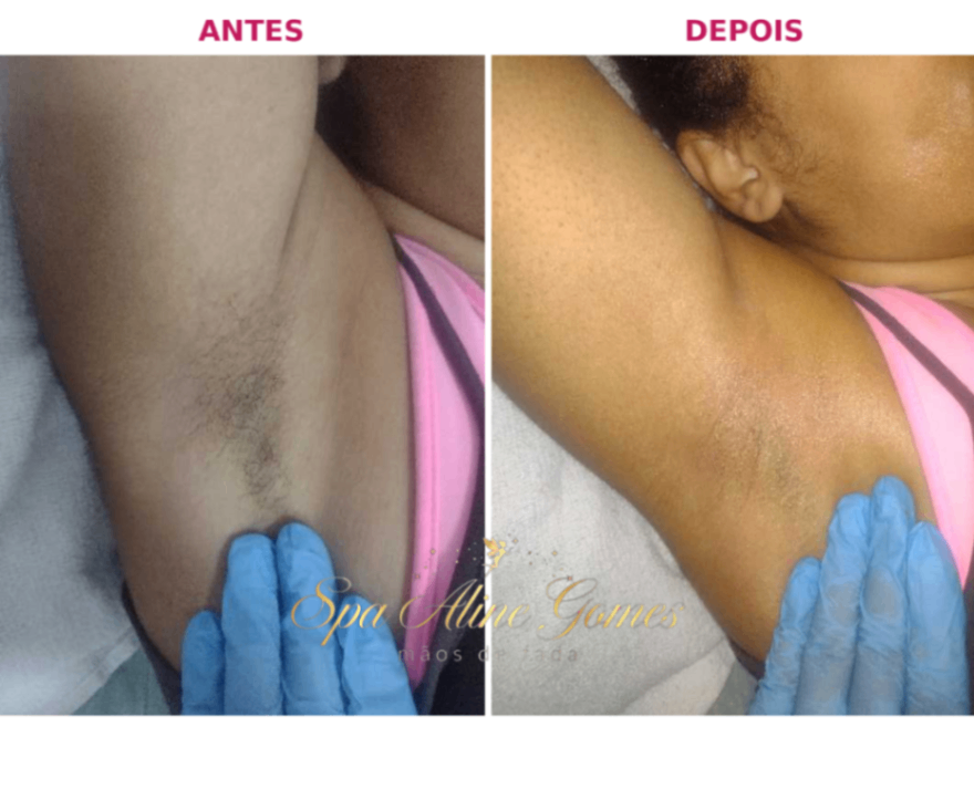 Trabalho de Massoterapeuta por Aline Gomes em Jardim Novo Horizonte, São Paulo — foto 6 de 6