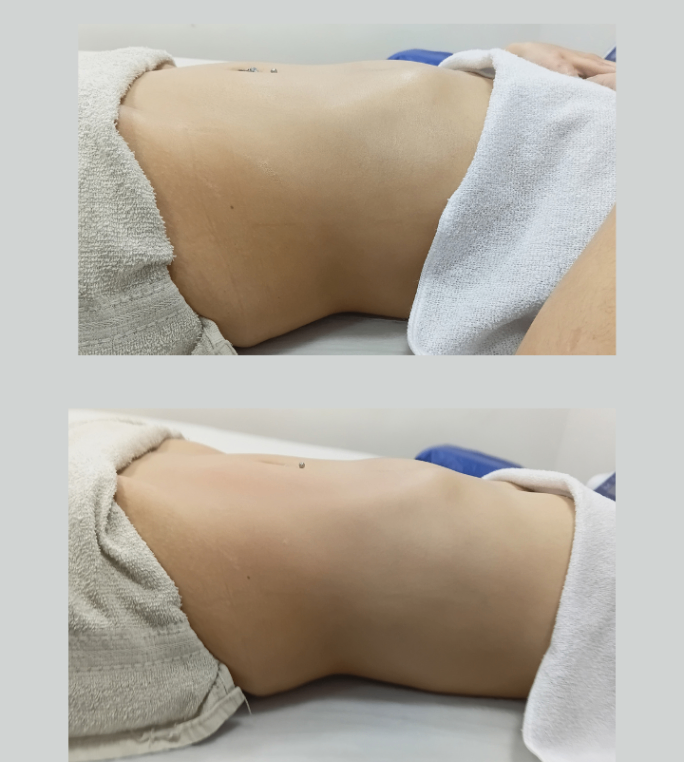 Trabalho de Esteticista por Vanessa Manenti em Conjunto Habitacional Padre Manoel da Nóbrega, São Paulo — foto 1 de 8