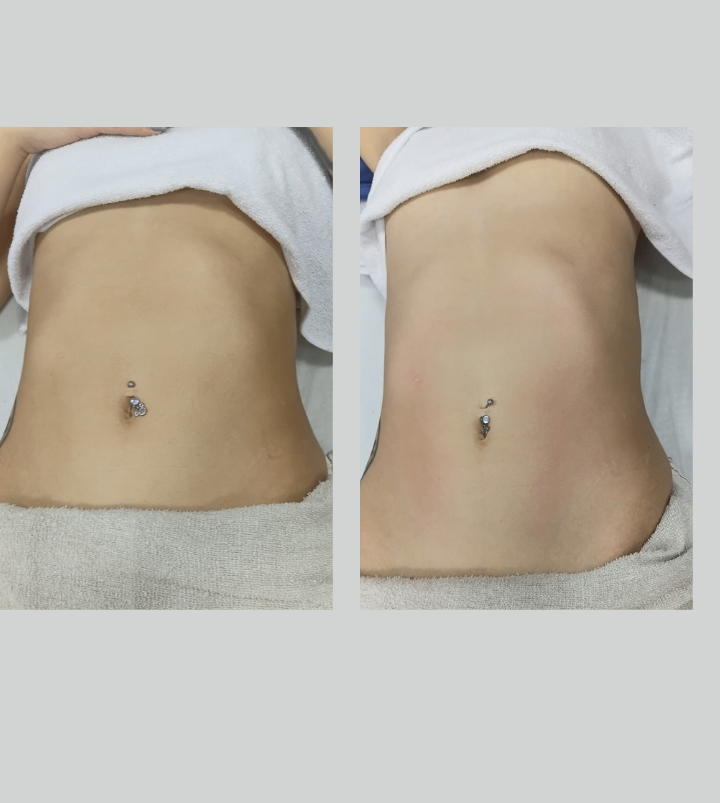 Trabalho de Esteticista por Vanessa Manenti em Conjunto Habitacional Padre Manoel da Nóbrega, São Paulo — foto 2 de 8