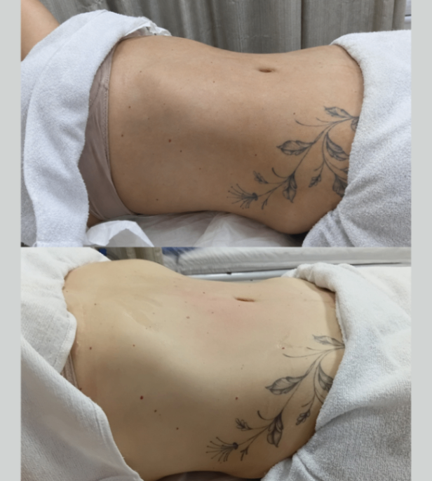 Trabalho de Esteticista por Vanessa Manenti em Conjunto Habitacional Padre Manoel da Nóbrega, São Paulo — foto 5 de 8