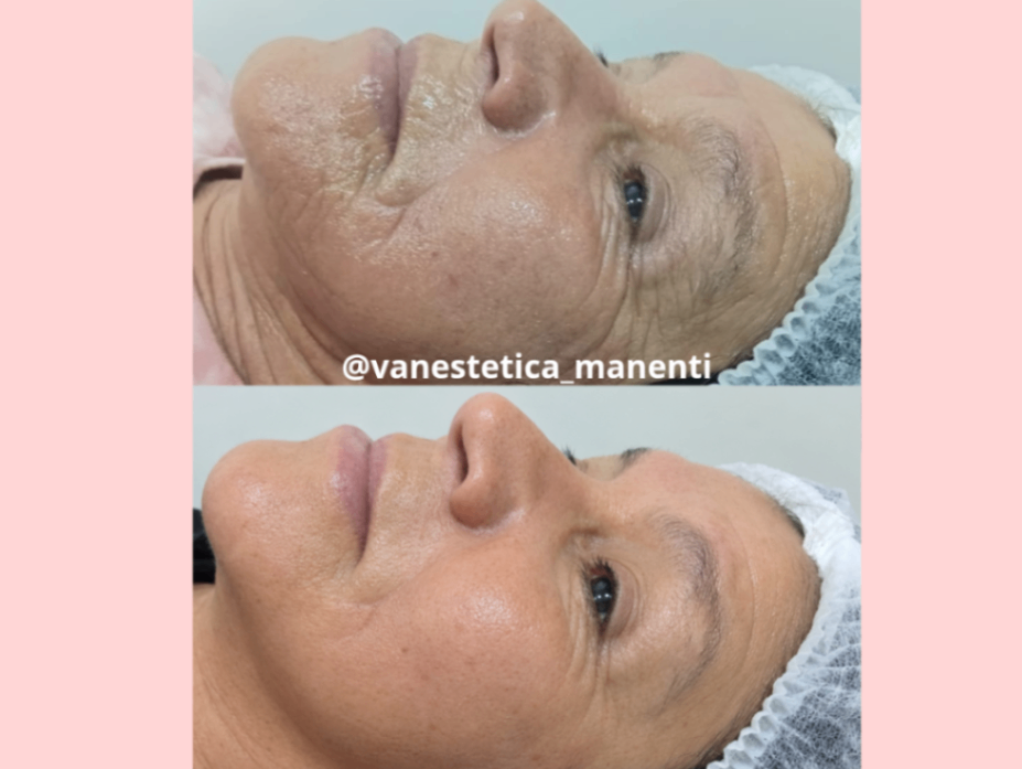 Trabalho de Esteticista por Vanessa Manenti em Conjunto Habitacional Padre Manoel da Nóbrega, São Paulo — foto 6 de 8